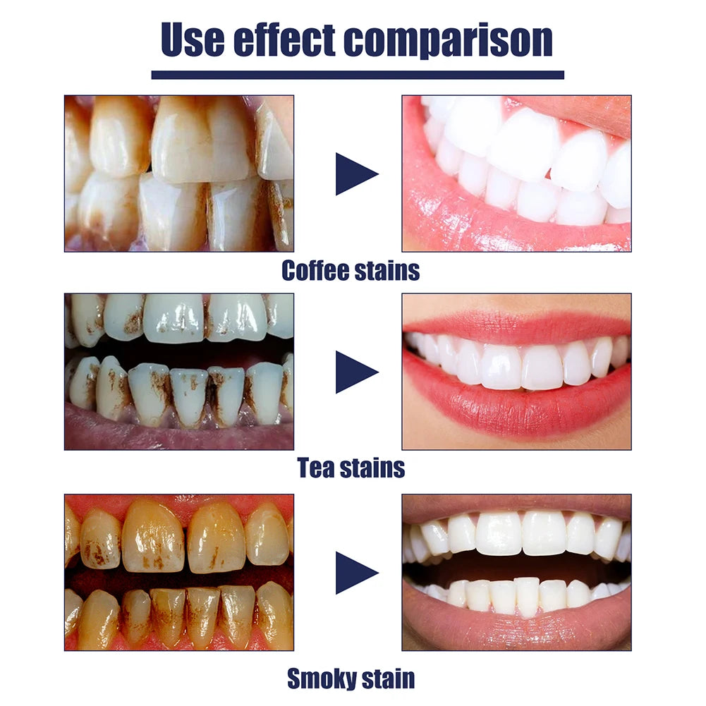 SMILEXSHINE PASTE